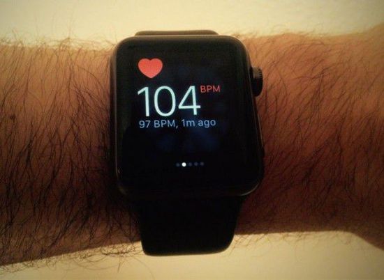Apple Watch監測功能又立功 救了17歲小伙